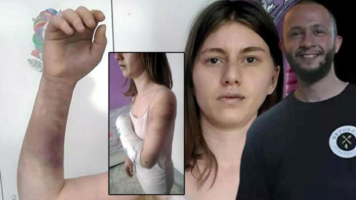 Sevgilisini beyzbol sopasıyla döven sanığa 10 ay hapis