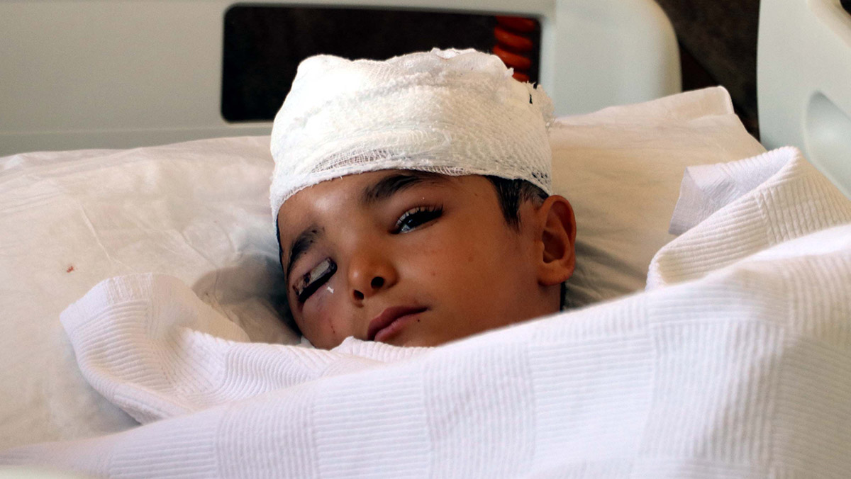 Köpeğin saldırdığı Nihatcan'ın saç derisi koptu