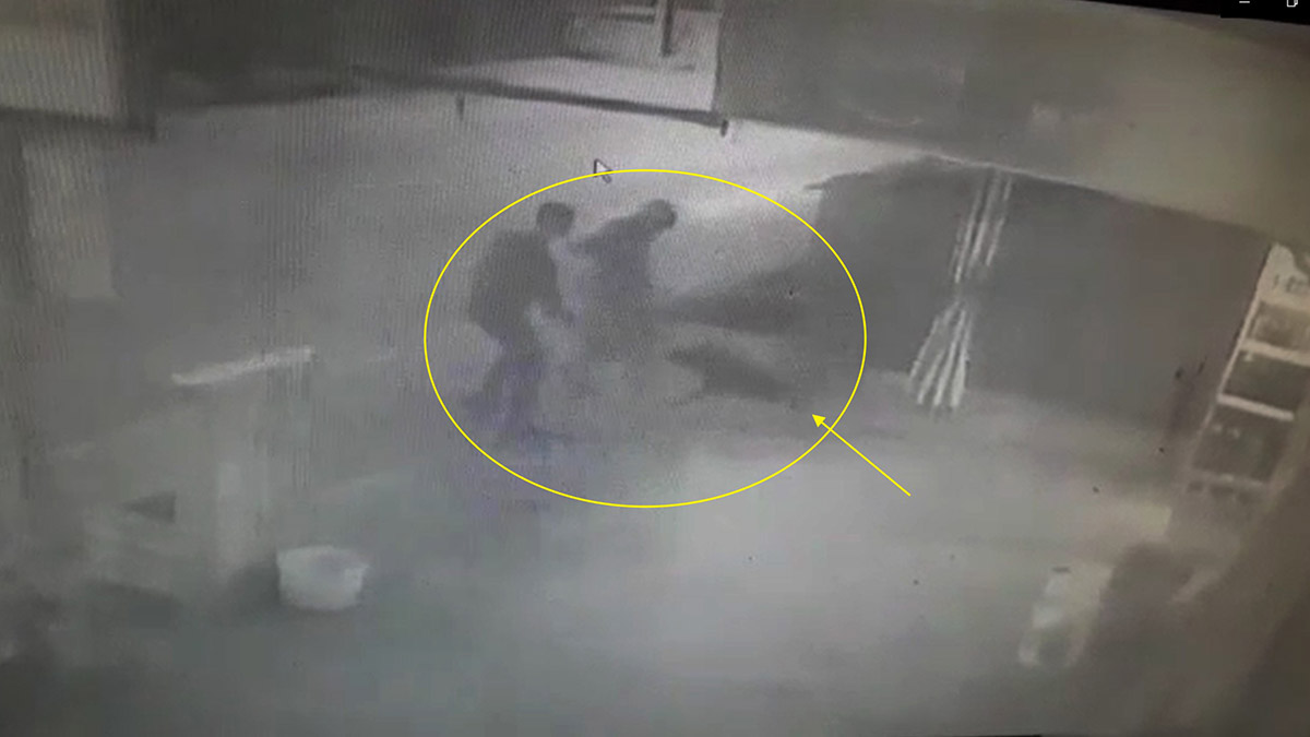 Osmaniye’de köpeğin saldırdığı çocuk yaralandı