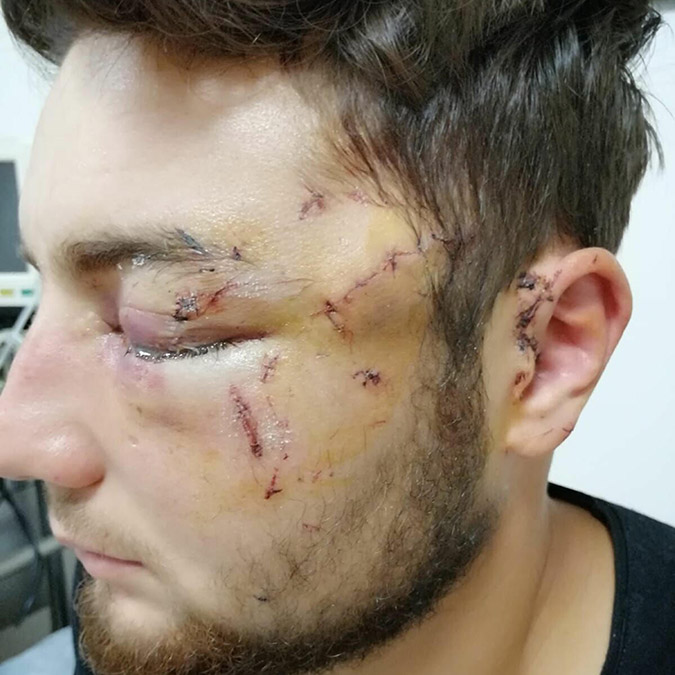 Kavgada gözünü kaybeden Egemen için iddianame hazırlandı