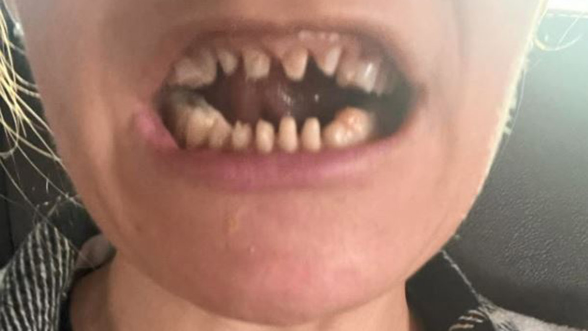 Danimarkalı ikizler; Yere bakarak yürüyoruz