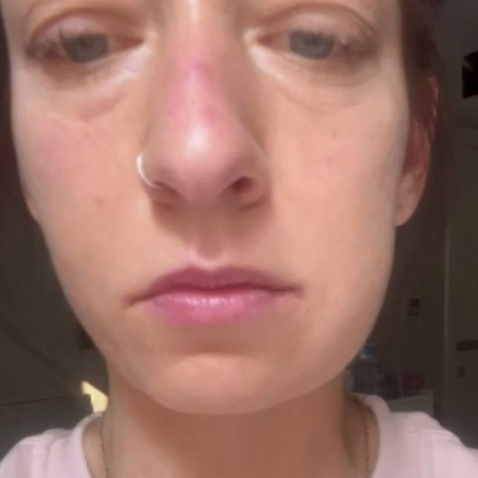 Danimarkalı ikizler; Yere bakarak yürüyoruz