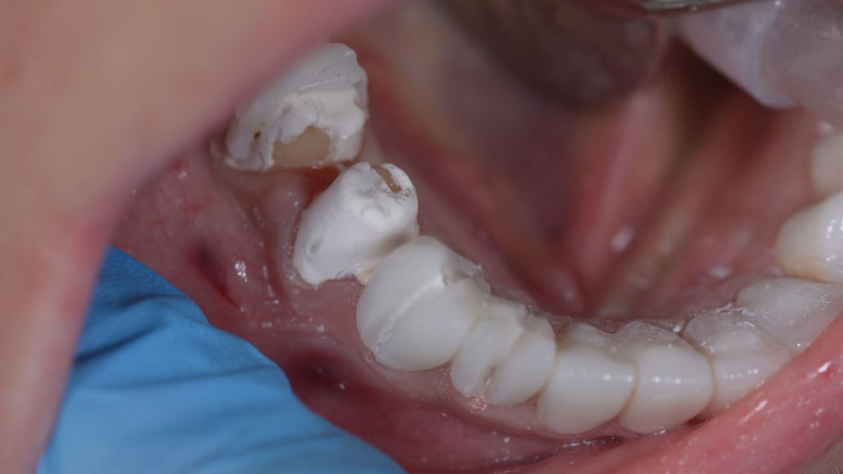 Danimarkalı ikizlerden savunma