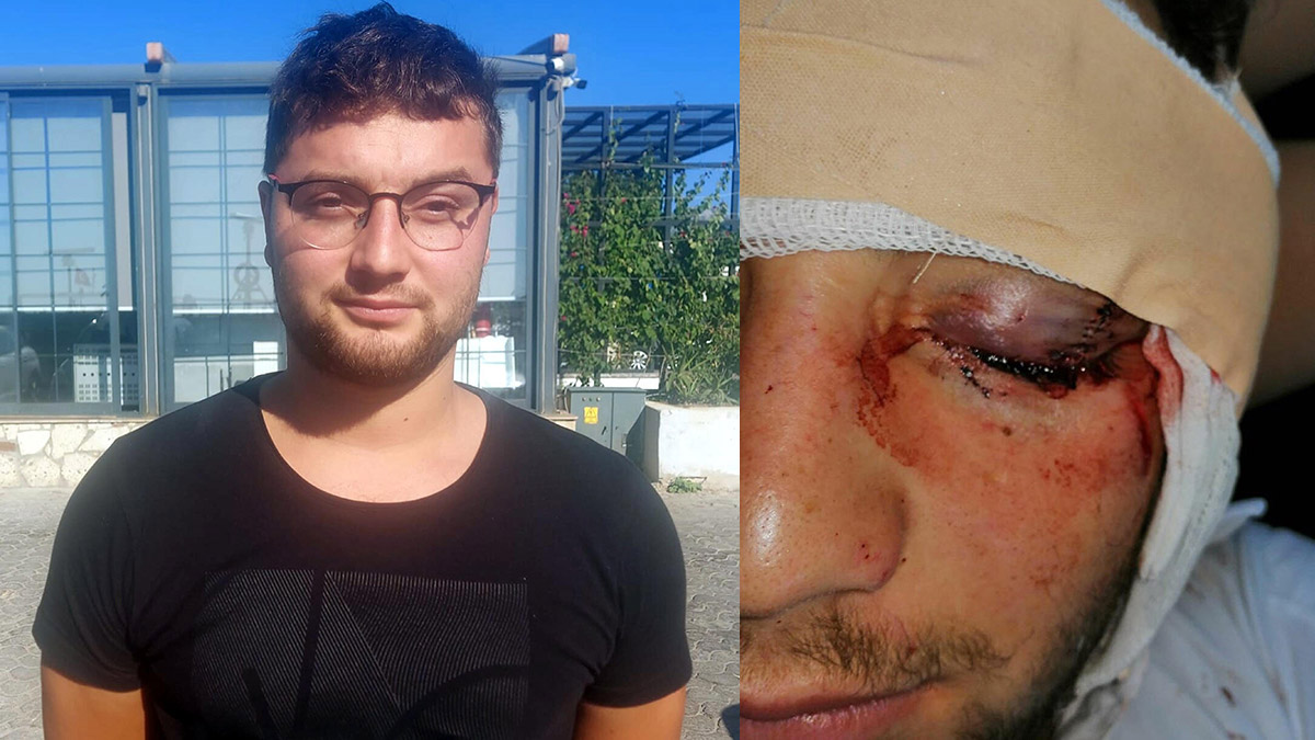 Kavgada gözünü kaybeden Egemen için iddianame hazırlandı