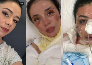 Alkol dolumunda meslektaşlarını yaraladı; 'Çakmak cebimdeydi' dedi