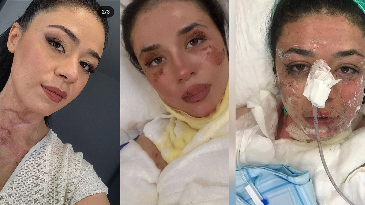 Alkol dolumunda meslektaşlarını yaraladı; 'Çakmak cebimdeydi' dedi