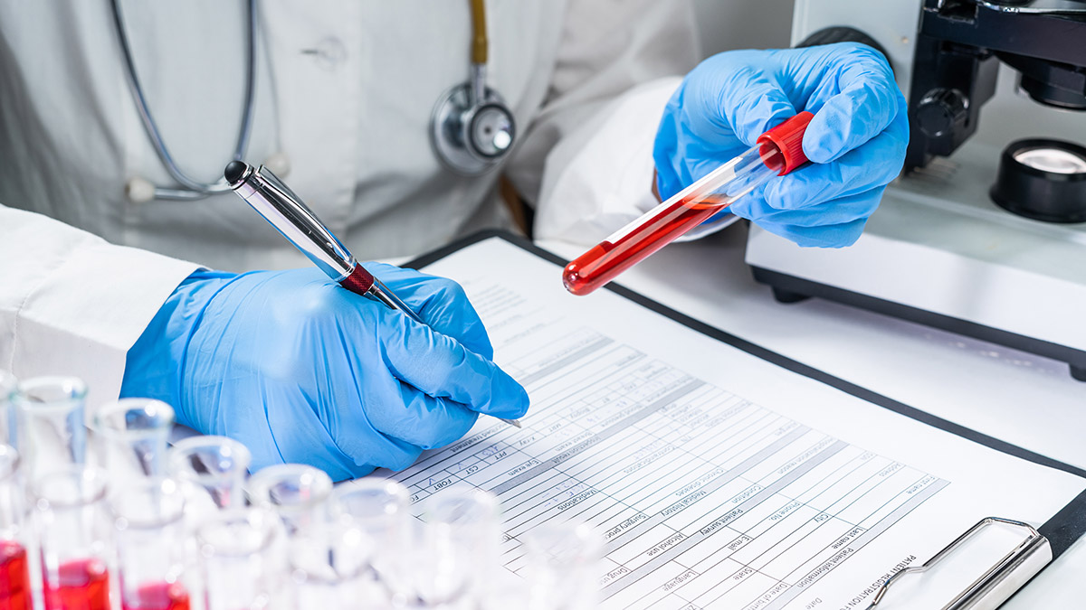 Türkiye'de HIV görülme yaşı 15'e kadar indi