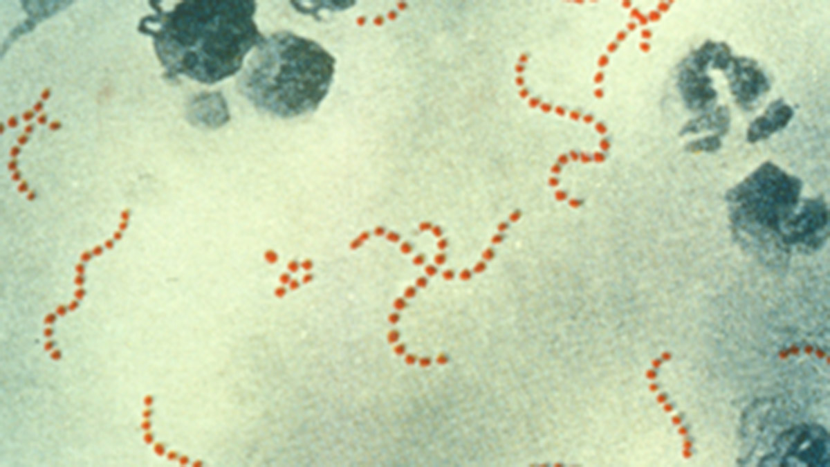 İngiltere'de Strep A'dan 122 kişi öldü