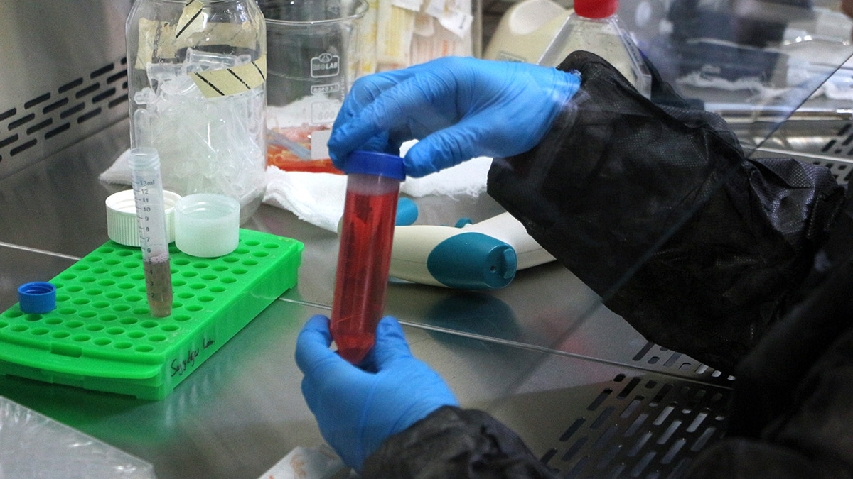 Koronavirüsün kanser hücrelerin yayılımını hızlandırdığı ortaya çıktı