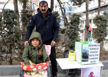 Nakşin protez kol ve bacak istiyor