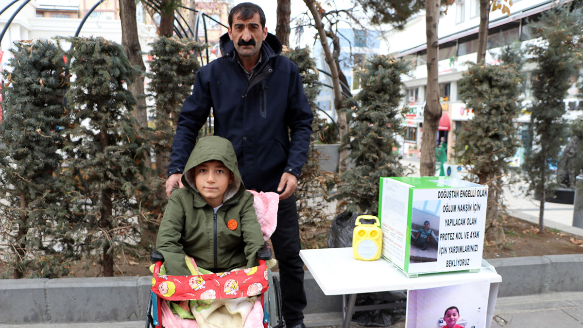 Nakşin protez kol ve bacak istiyor