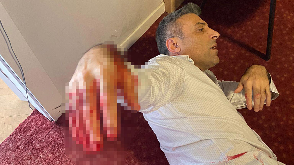 Öztürk Yılmaz'a bıçaklı saldırı; Saldırgan yakalandı