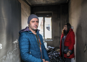 Ameliyat paraları yangında kül oldu