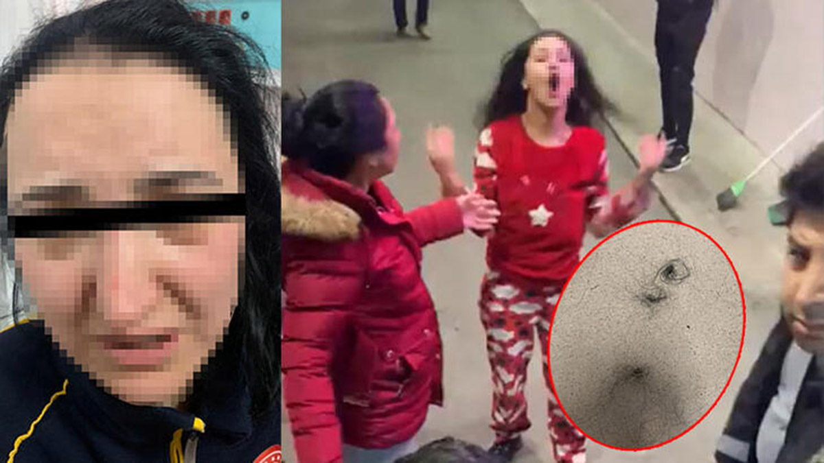 Darp raporu isteyen hastadan 2 hemşireye saldırı