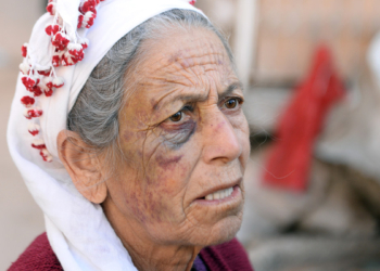 Evine giren gaspçıdan dakikalarca dayak yedi
