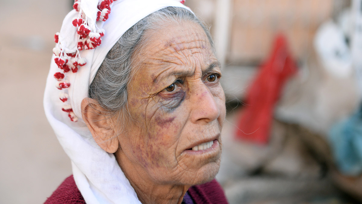 Evine giren gaspçıdan dakikalarca dayak yedi