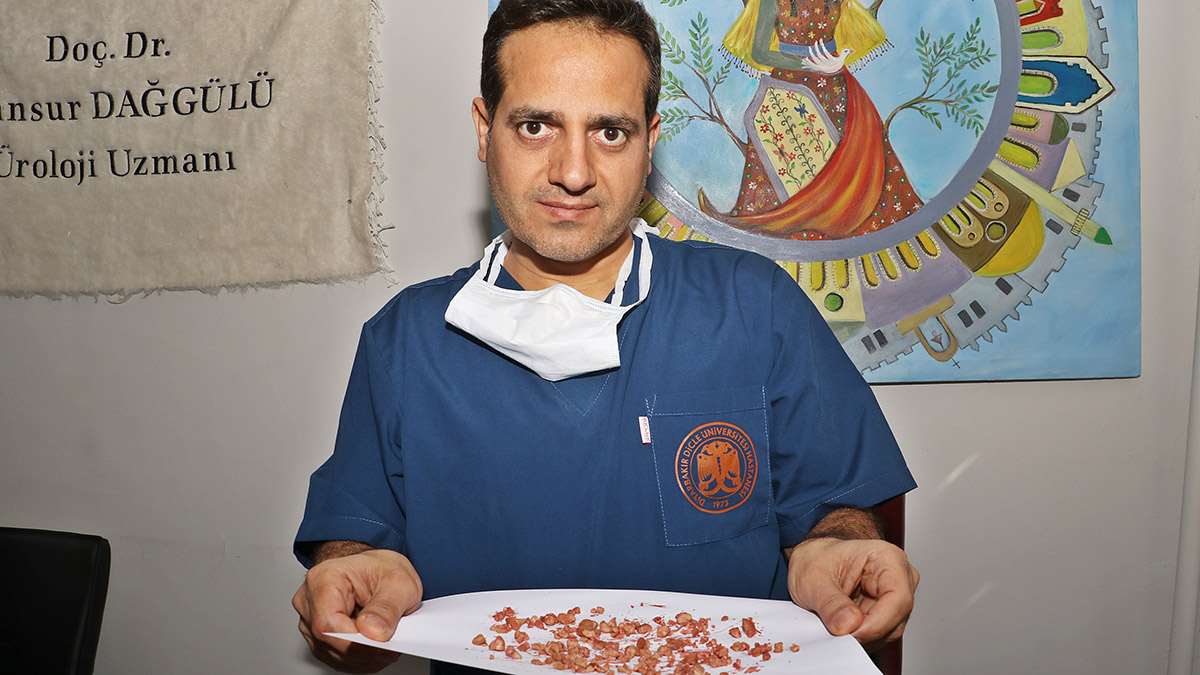 Hastanın böbreğini kaplayan taş bölünerek çıkarıldı 