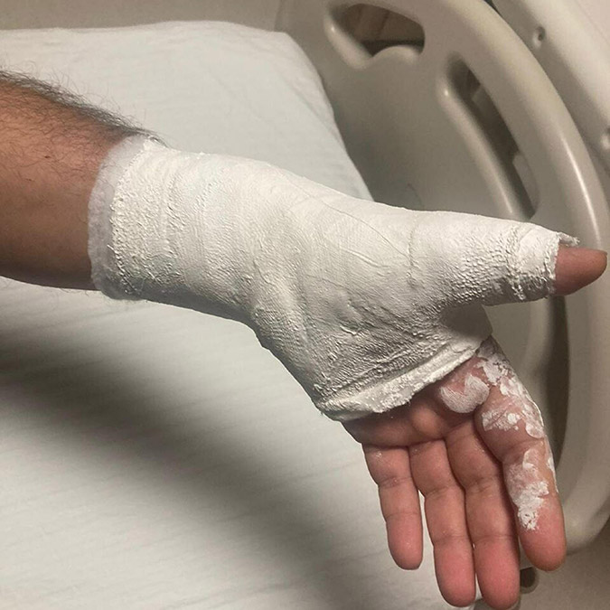 Kavgada darbedilen anestezi asistanı konuştu