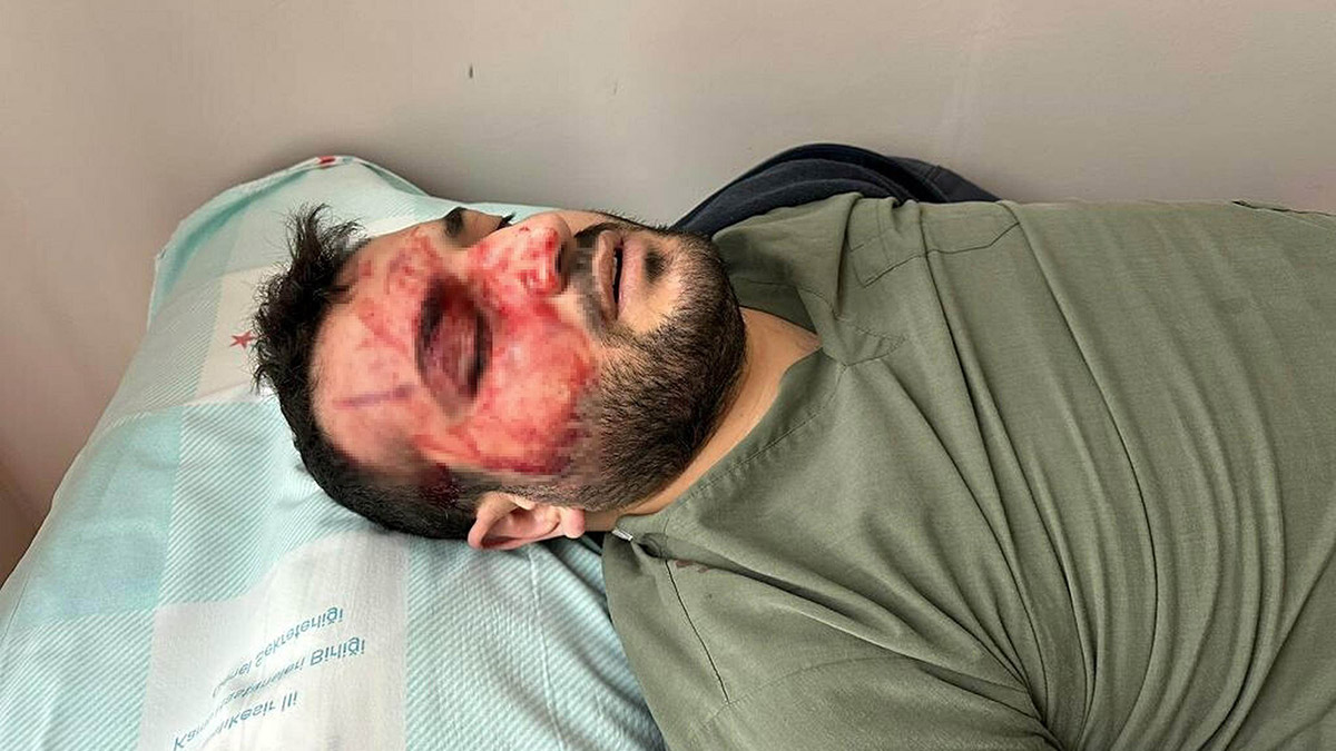 Kavgada darbedilen anestezi asistanı konuştu