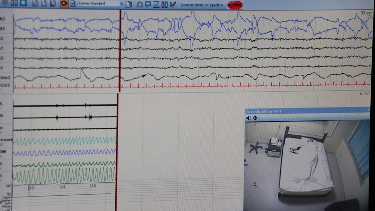 'Karabasan çökmesi' uykuda solunum yetmezliğinden olabilir