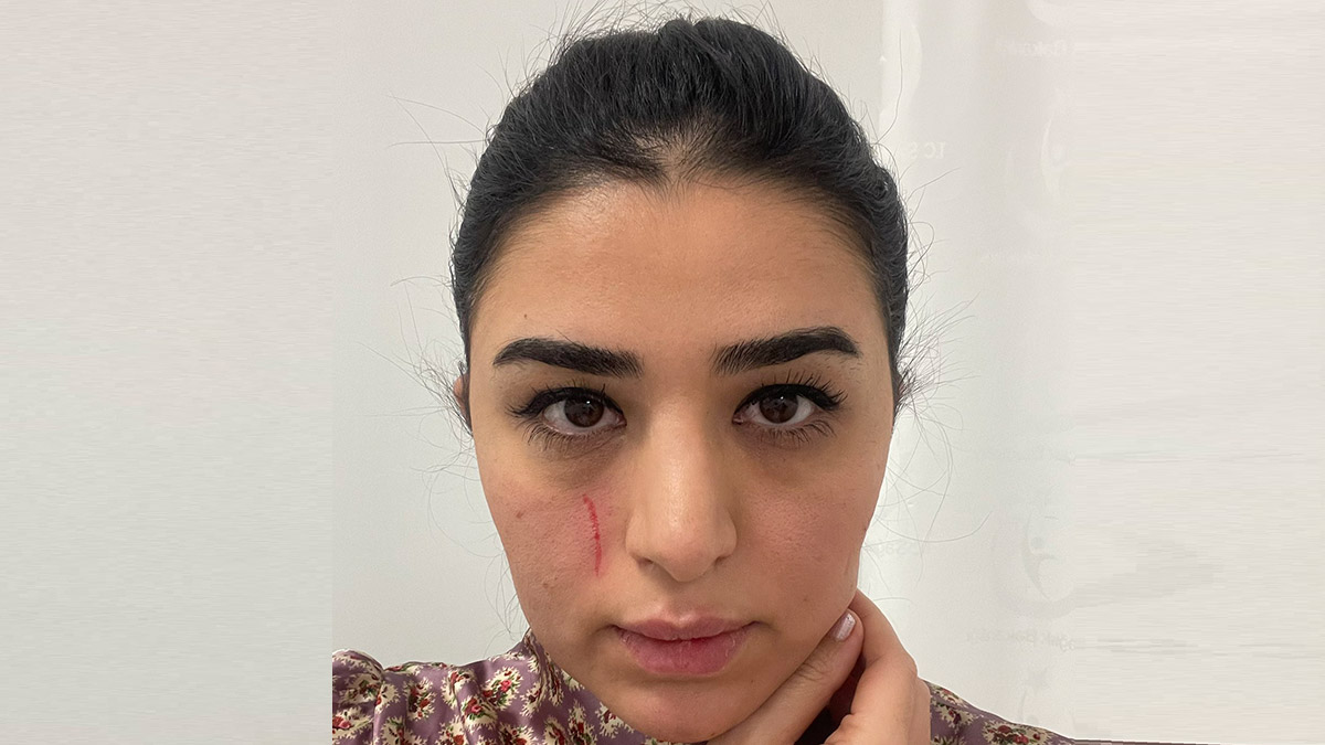 Mersin'de kadın doktoru darp edildi