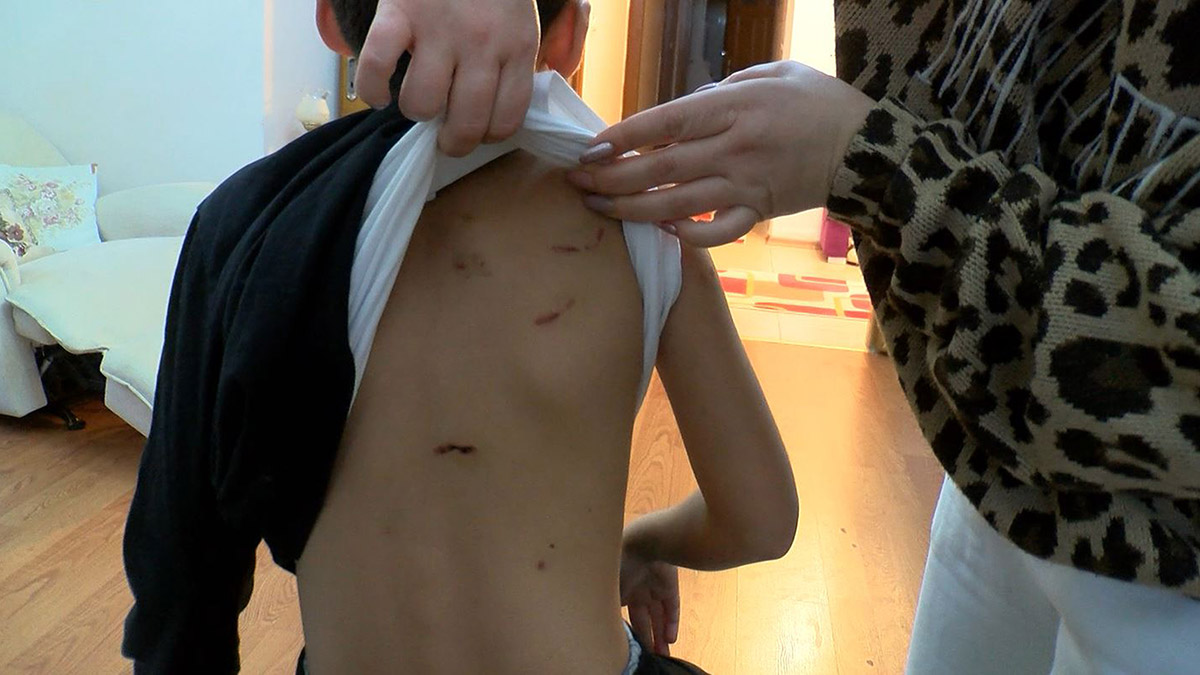 İlkokul öğrencisi sokak köpeklerinin saldırısına uğradı