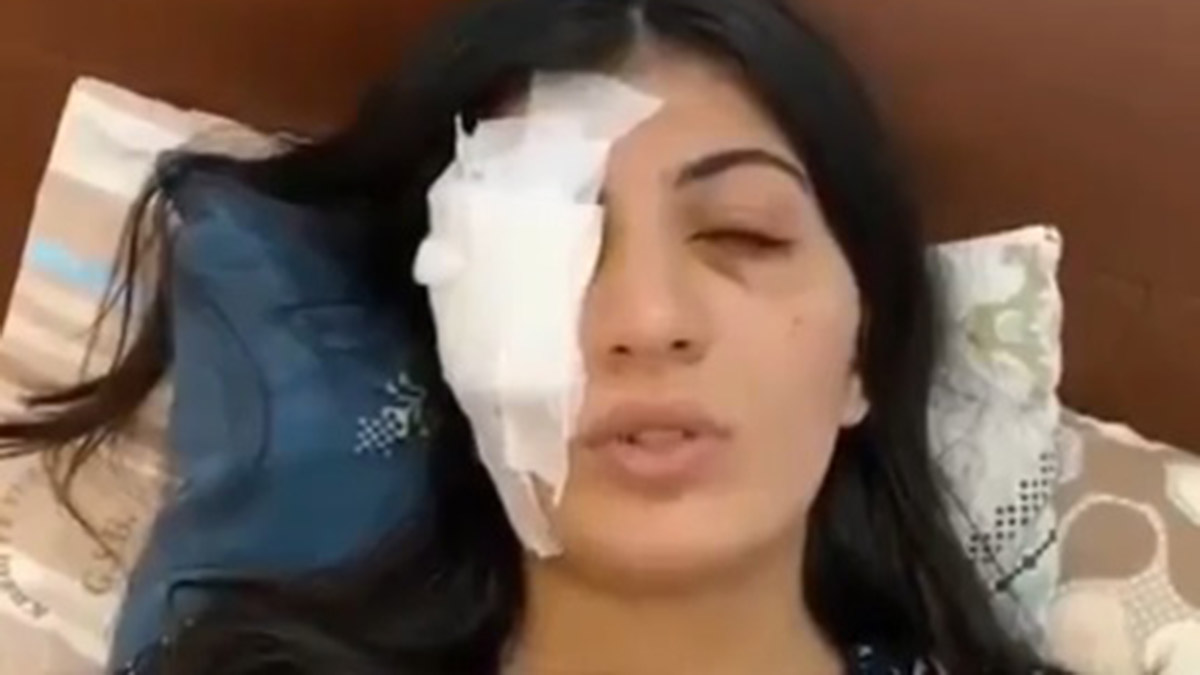 Hatice'yi su dolu balonla gözünden yaralayan sanıklar yargılanıyor