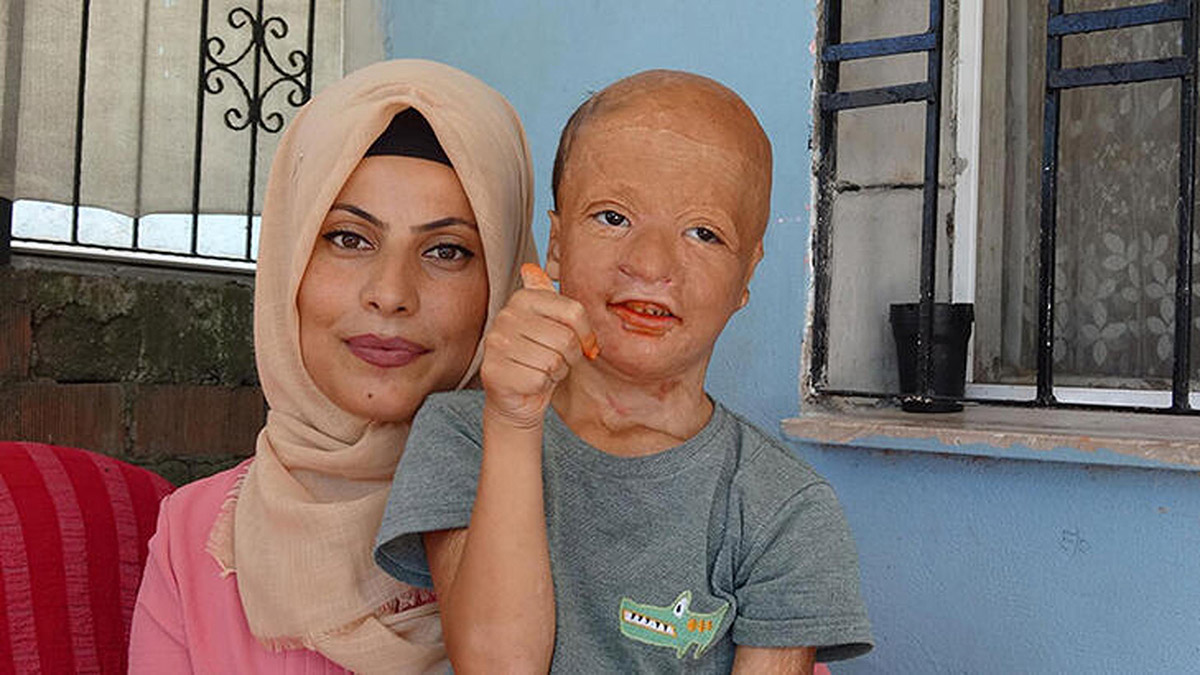 9 yaşındaki Halil, 3'ncü doku nakli için bekliyor