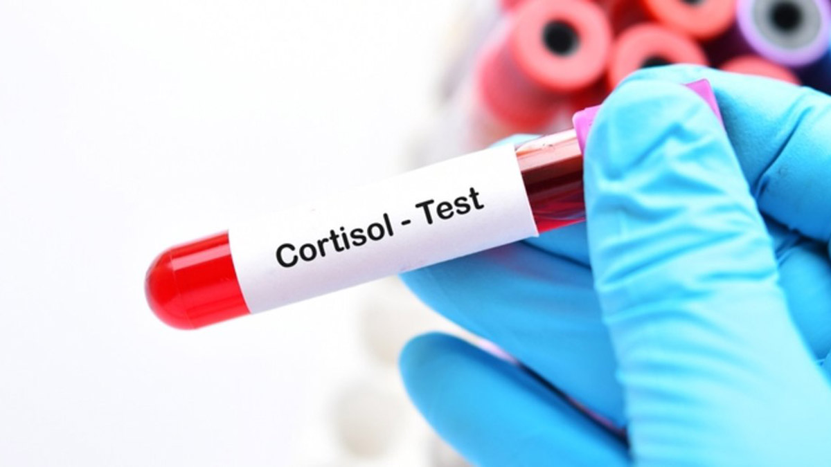 Deprem sonrası kortizol yükselmesine dikkat