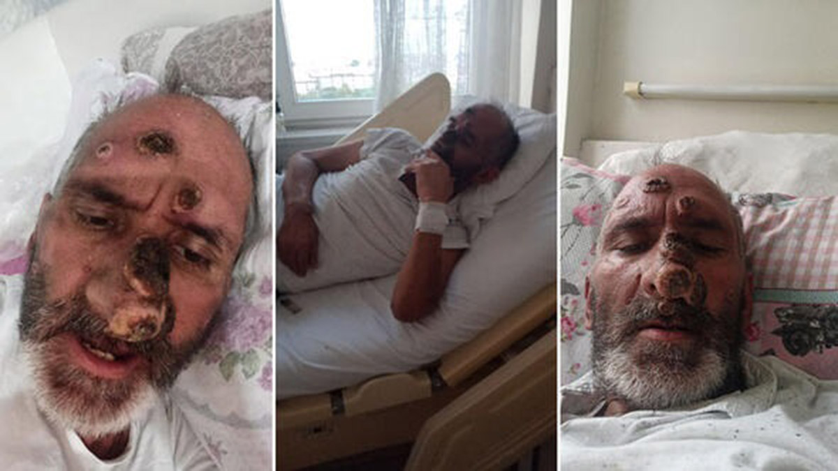 Sinek yüzünü tanınmayacak hale getirdi