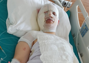 Depremzede eski eşini kaynar suyla yaktı
