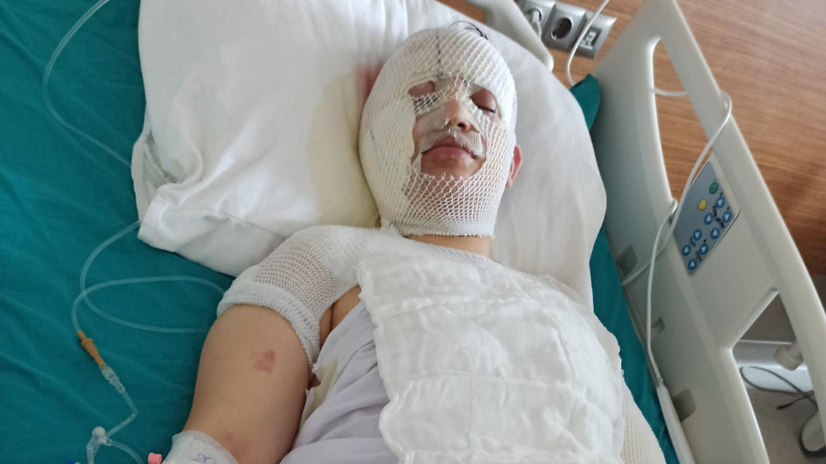 Depremzede eski eşini kaynar suyla yaktı