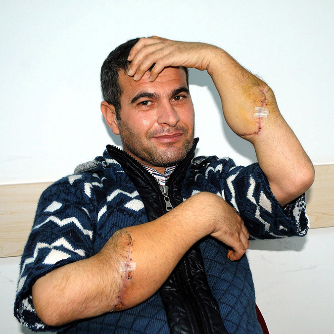 Türkiye'nin 4'üncü çift kol nakillisi depremde can verdi