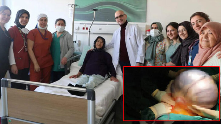 Karnından 35 santimlik kitle çıktı