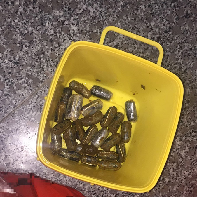 Tomografi filminde bağırsaklarında uyuşturucu çıktı