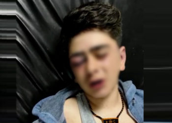 14 yaşındaki çocuğa polis tarafından işkence iddialarına soruşturma