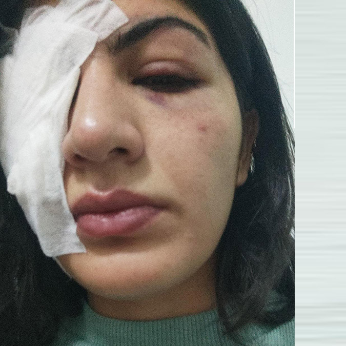 Su dolu balonla Hatice'yi yaralayanlar tahliye edildi