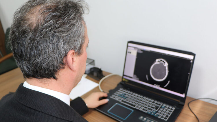 Nörolojik hastalıklara ‘yapay zeka’ ile tedavi