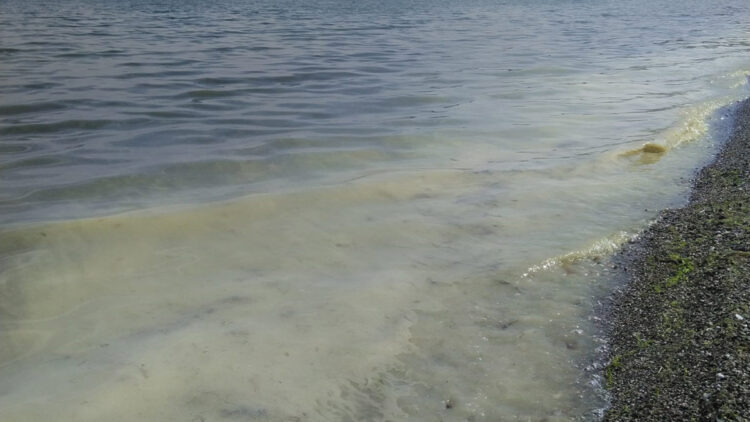 Prof. Dr. Sarı: Şu an kremsi müsilajı görüyoruz