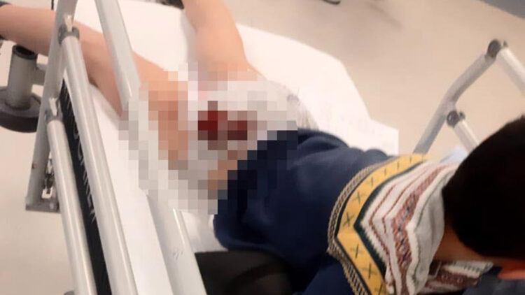 Sokak köpeğinin saldırdığı Yavuz, yaralandı