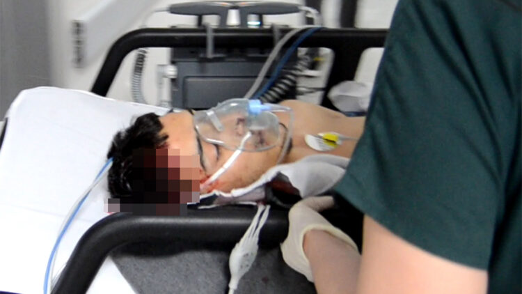 Aksaray'da tabancayla başından vuruldu