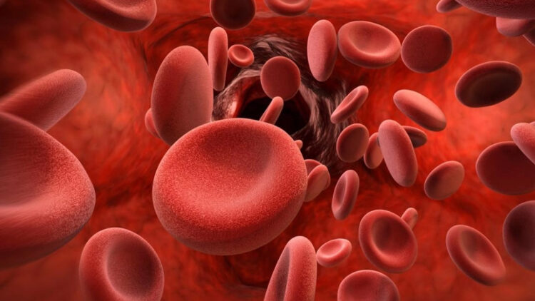 Hemofili hastalığı sünnet sonrası ortaya çıkıyor