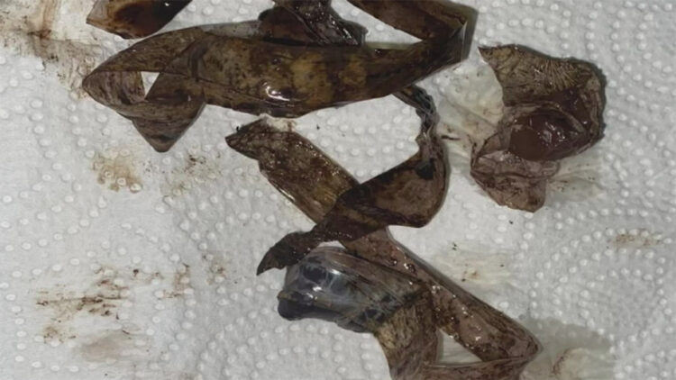 Midesine sakladığı uyuşturucu kapsüller patlayınca öldü