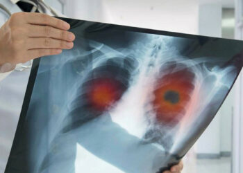 KOAH: Akciğer ve nefes