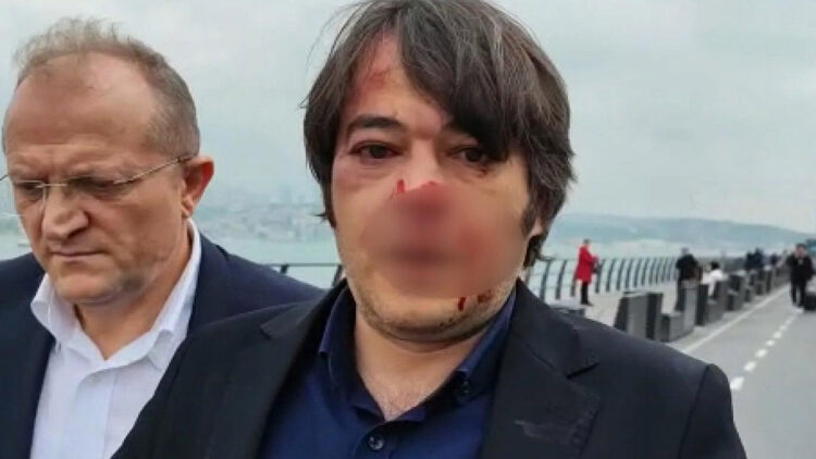 Üsküdar'da kaçak yapıların yıkımında arbede 