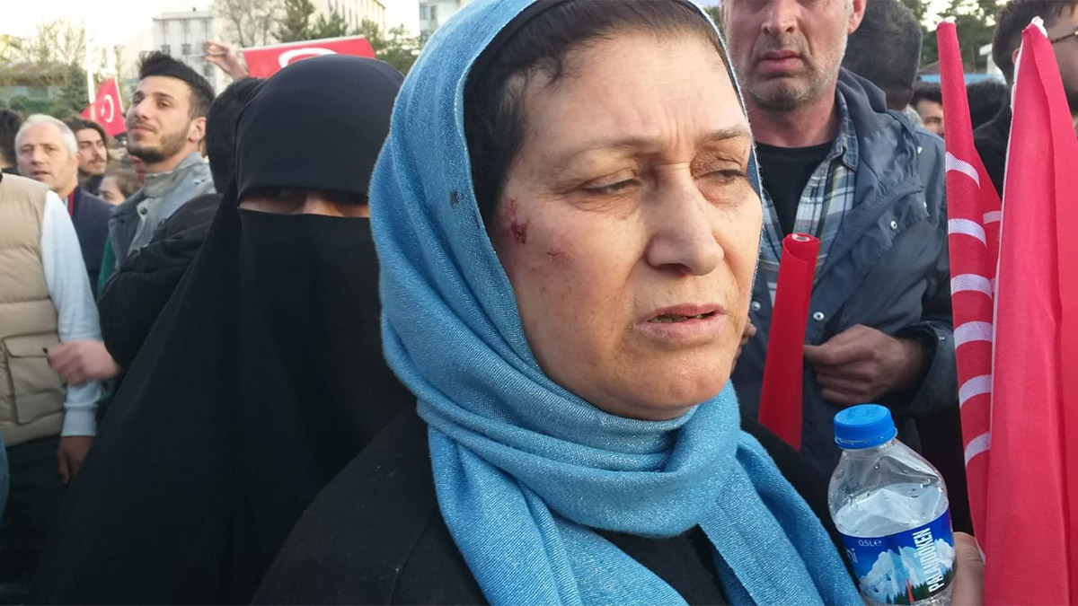 İstanbul Büyükşehir Belediye Başkanı Ekrem İmamoğlu, saldırının ardından Twitter hesabından 'Yaşanan olayların Erzurumlularla ilgisi yoktur. Yaralı vatandaşlarımızla konuşuyor, durumlarını yakından takip ediyorum' başlığıyla canlı yayında olaya ilişkin açıklamalarda bulundu.