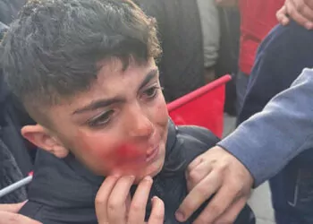 İmamoğlu'nun konuşması sırasında çıkan olaylarda yaralanan 17 kişi taburcu edildi