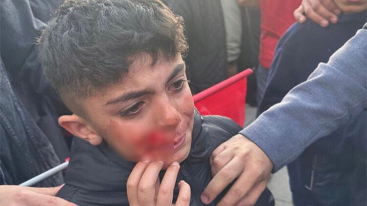 İmamoğlu'nun konuşması sırasında çıkan olaylarda yaralanan 17 kişi taburcu edildi