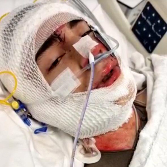 Vagon üzerinde selfie yaparken akıma kapıldı