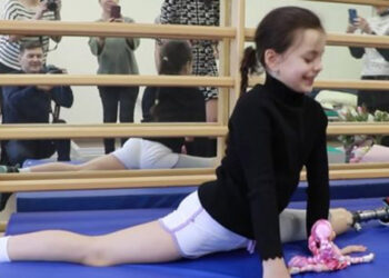 Bacağını kaybeden oleksandra paskal'ın cimnastik başarısı